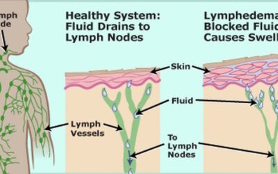 The Lymphatic System and the Skin