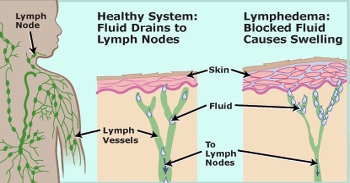 The Lymphatic System and the Skin - Skin Inspiration